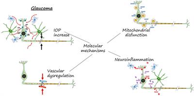 Glaucoma: from pathogenic mechanisms to retinal glial cell response to damage